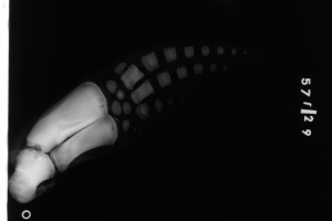 Ein Röntgenbild eines menschlichen Beins mit einer sichtbaren Fraktur am Knöchel, mit Text auf der rechten Seite vor schwarzem Hintergrund.