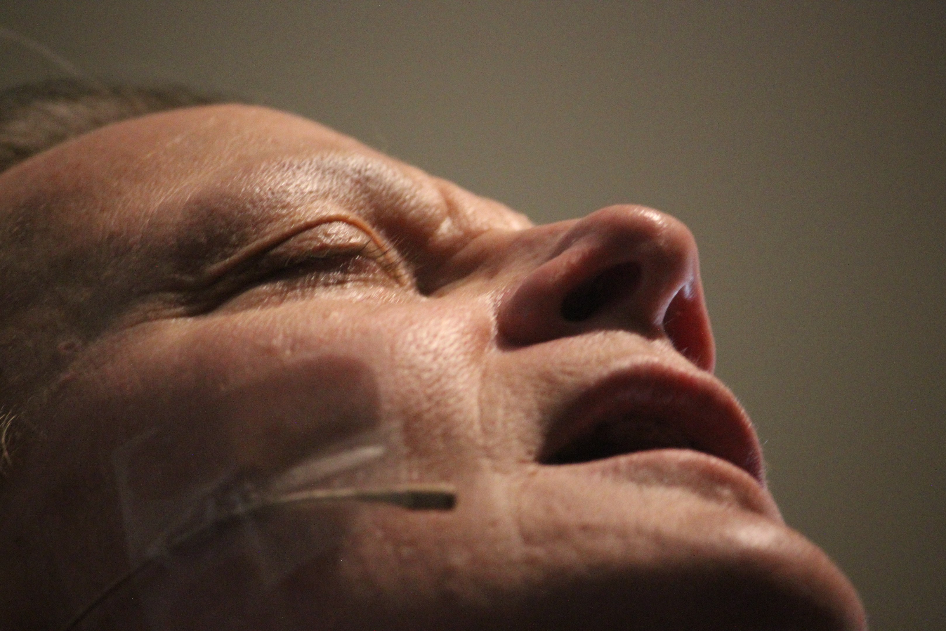 Nahaufnahme eines Frauengesichts mit geschlossenen Augen, die eine Behandlung mit Nadeln in der Nase gegen einen einfarbigen Wandhintergrund erhält.